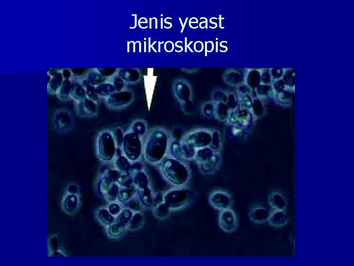 Jenis yeast mikroskopis 