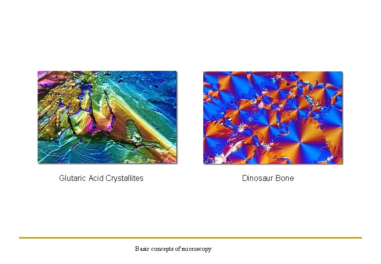 Glutaric Acid Crystallites Basic concepts of microscopy Dinosaur Bone 