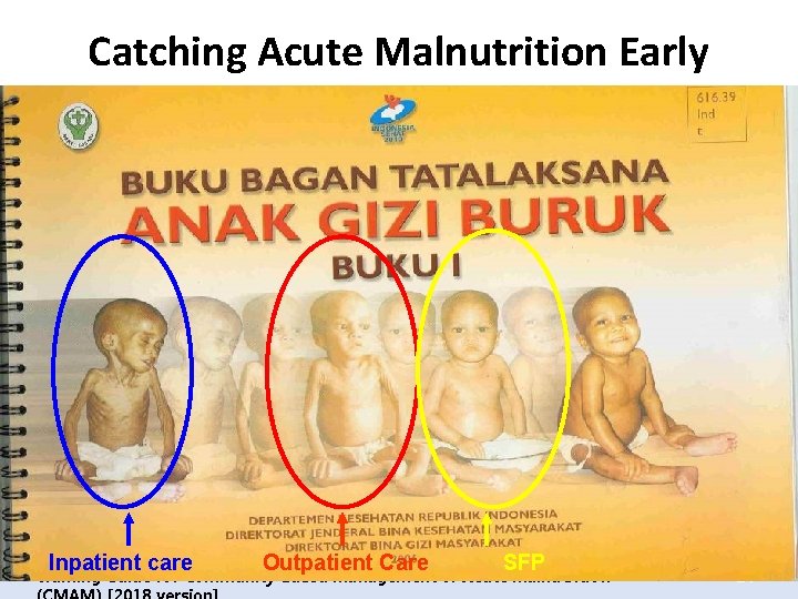 Catching Acute Malnutrition Early Inpatient care Outpatient Care SFP Training Guide for Community-Based Management