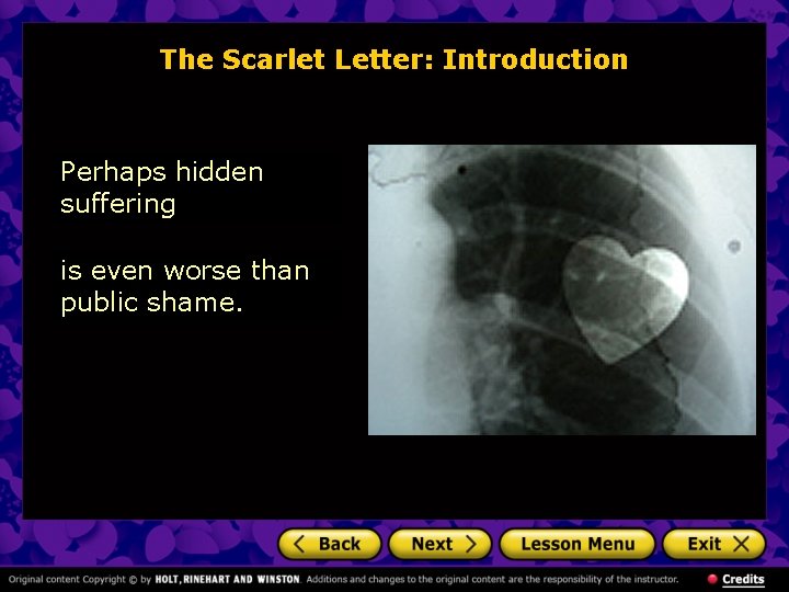 The Scarlet Letter: Introduction Perhaps hidden suffering is even worse than public shame. 