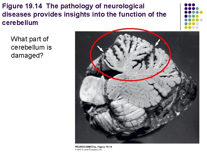 Figure 19. 14 The pathology of neurological diseases provides insights into the function of