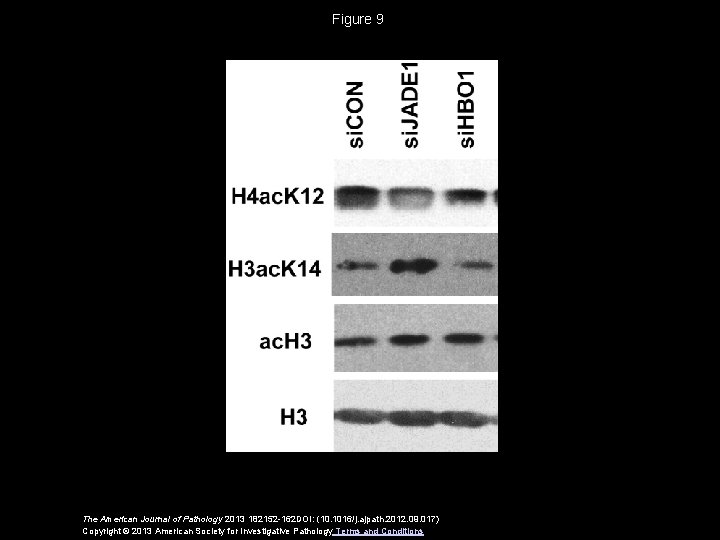 Figure 9 The American Journal of Pathology 2013 182152 -162 DOI: (10. 1016/j. ajpath.