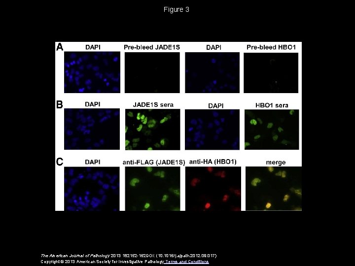 Figure 3 The American Journal of Pathology 2013 182152 -162 DOI: (10. 1016/j. ajpath.
