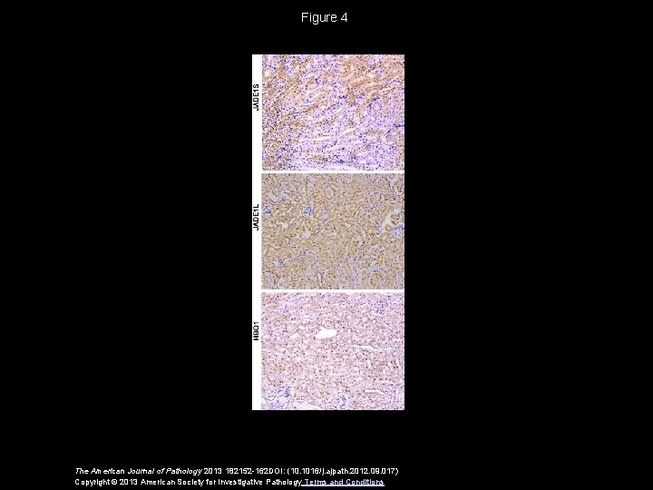 Figure 4 The American Journal of Pathology 2013 182152 -162 DOI: (10. 1016/j. ajpath.
