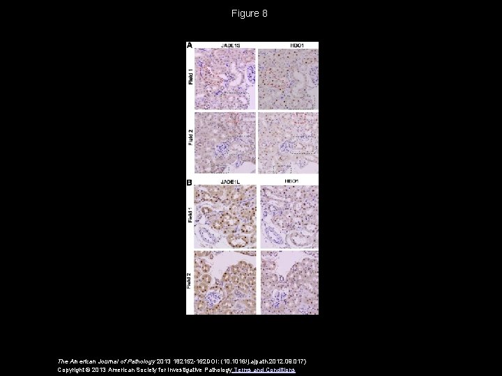 Figure 8 The American Journal of Pathology 2013 182152 -162 DOI: (10. 1016/j. ajpath.