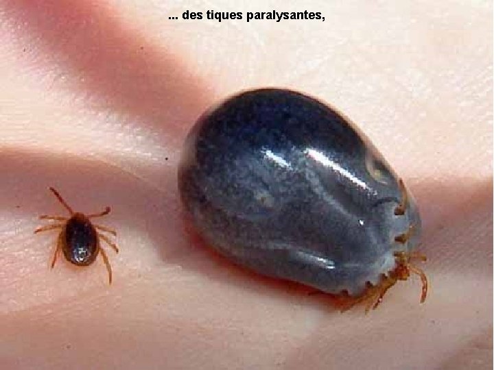 . . . des tiques paralysantes, 