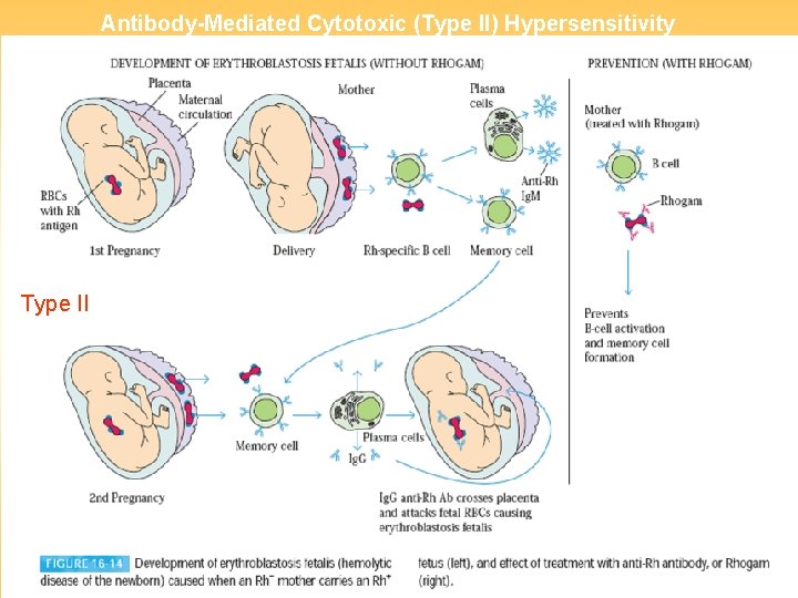 Antibody-Mediated Cytotoxic (Type II) Hypersensitivity Type II 