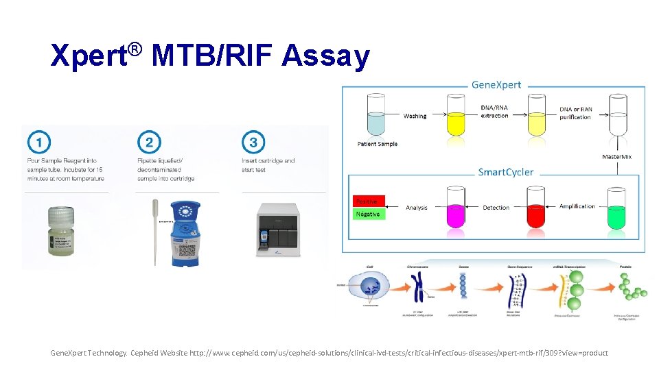 Xpert® MTB/RIF Assay Gene. Xpert Technology. Cepheid Website http: //www. cepheid. com/us/cepheid-solutions/clinical-ivd-tests/critical-infectious-diseases/xpert-mtb-rif/309? view=product 