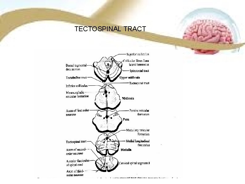 TECTOSPINAL TRACT 