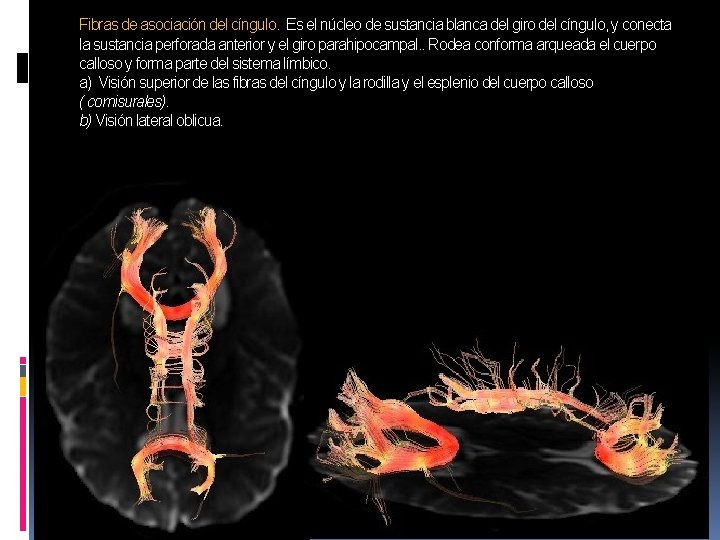 Fibras de asociación del cíngulo. Es el núcleo de sustancia blanca del giro del