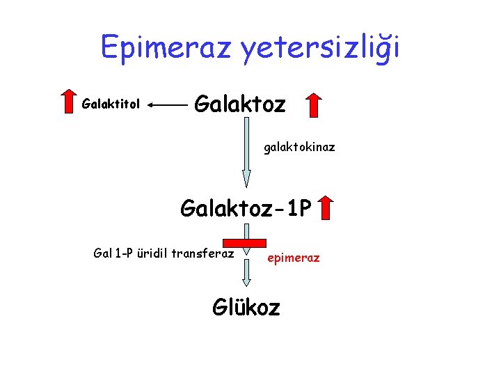 Epimeraz yetersizliği Galaktitol Galaktoz galaktokinaz Galaktoz-1 P Gal 1 -P üridil transferaz epimeraz Glükoz