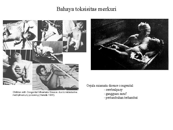 Bahaya toksisitas merkuri Gejala miamata disease congenital: - serebralpasy - gangguan saraf - pertumbuhan