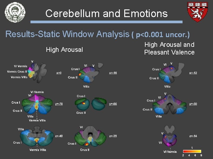 Cerebellum and Emotions Results-Static Window Analysis ( p<0. 001 uncor. ) High Arousal and