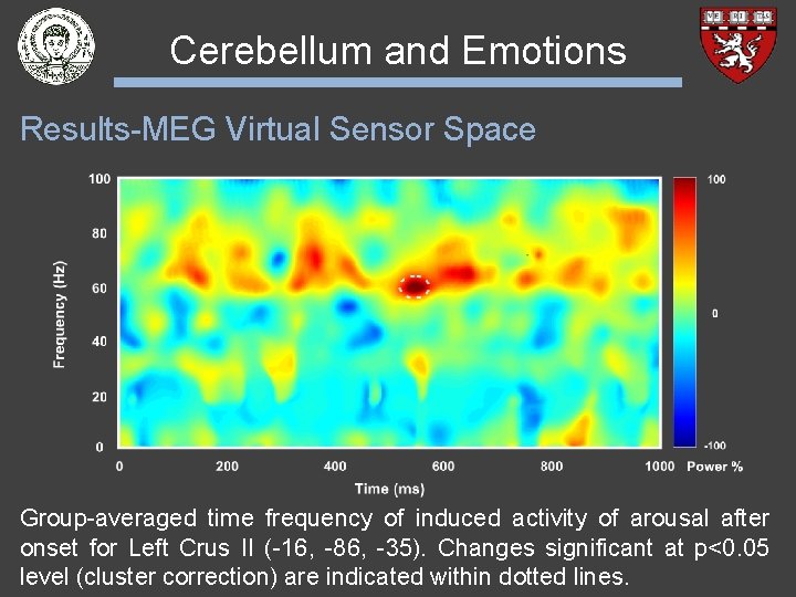 Cerebellum and Emotions Results-MEG Virtual Sensor Space Group-averaged time frequency of induced activity of