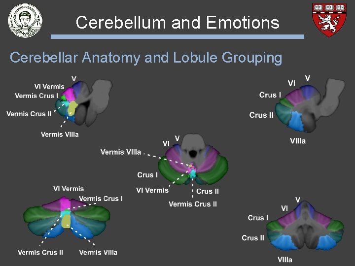 Cerebellum and Emotions Cerebellar Anatomy and Lobule Grouping 