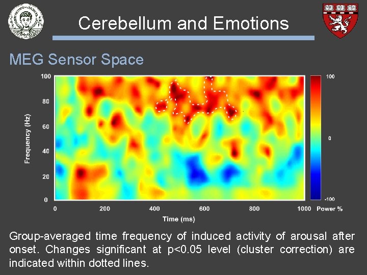 Cerebellum and Emotions MEG Sensor Space Group-averaged time frequency of induced activity of arousal