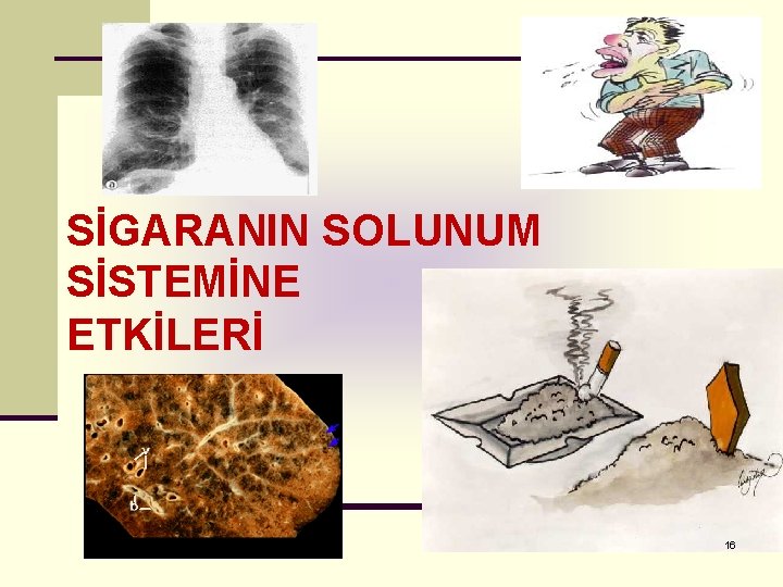 SİGARANIN SOLUNUM SİSTEMİNE ETKİLERİ 16 