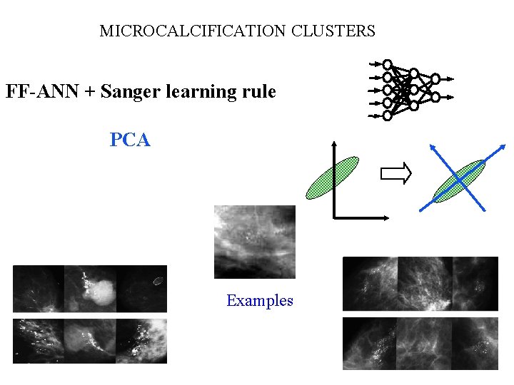 MICROCALCIFICATION CLUSTERS FF-ANN + Sanger learning rule PCA Examples 