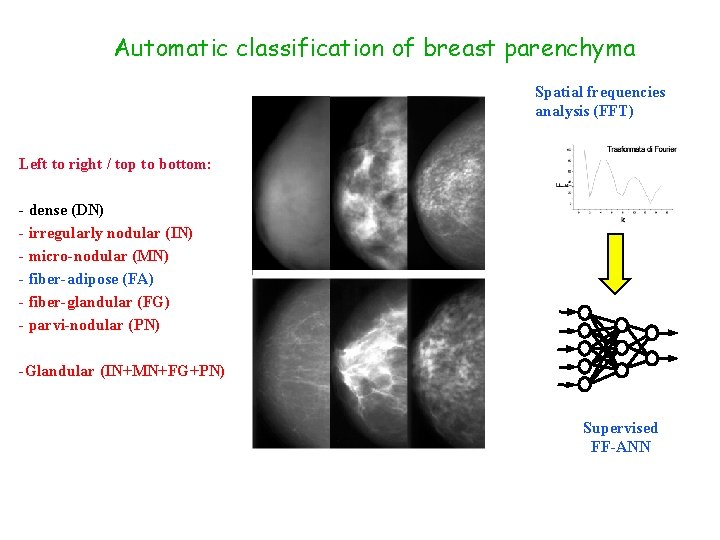 Automatic classification of breast parenchyma Spatial frequencies analysis (FFT) Left to right / top
