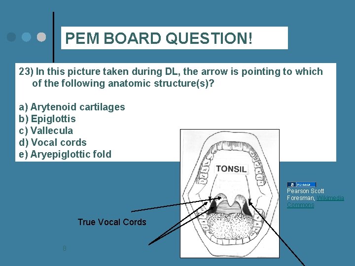 PEM BOARD QUESTION! 23) In this picture taken during DL, the arrow is pointing