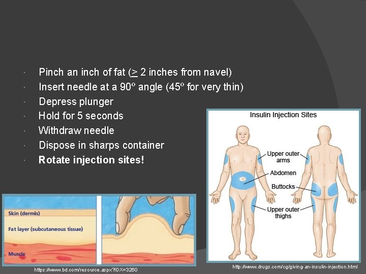  Pinch an inch of fat (> 2 inches from navel) Insert needle at