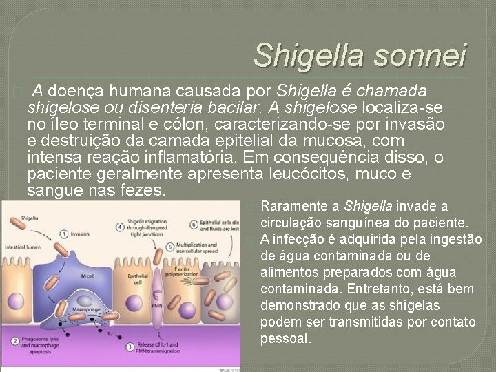 Shigella sonnei � A doença humana causada por Shigella é chamada shigelose ou disenteria