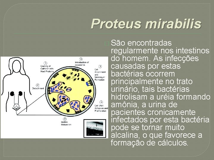 Proteus mirabilis � São encontradas regularmente nos intestinos do homem. As infecções causadas por