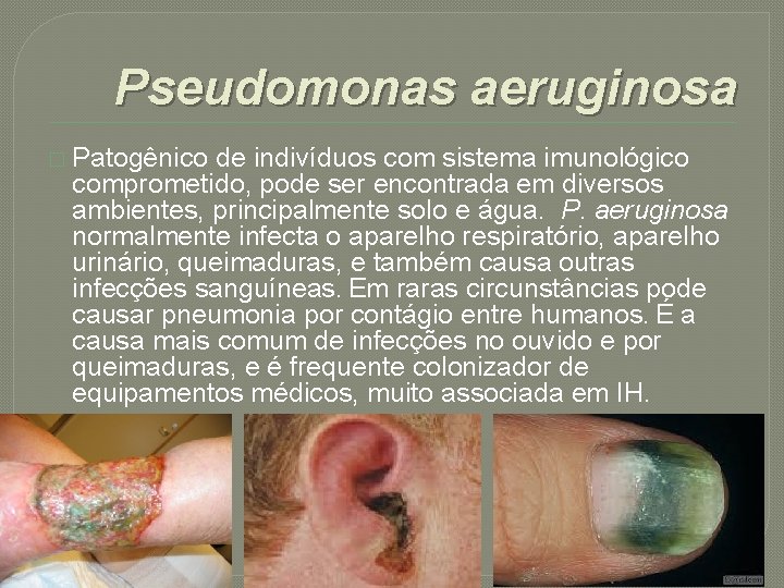 Pseudomonas aeruginosa � Patogênico de indivíduos com sistema imunológico comprometido, pode ser encontrada em