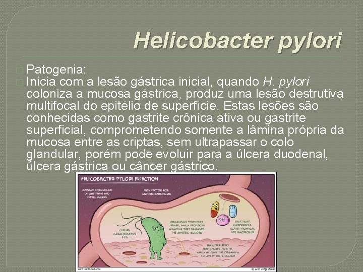 Helicobacter pylori � Patogenia: � Inicia com a lesão gástrica inicial, quando H. pylori