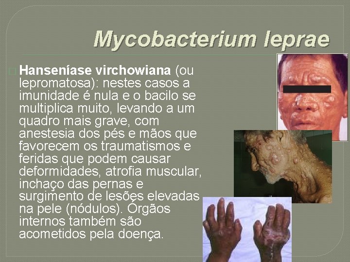 Mycobacterium leprae � Hanseníase virchowiana (ou lepromatosa): nestes casos a imunidade é nula e