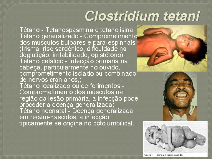 Clostridium tetani � � � Tétano - Tetanospasmina e tetanolisina Tétano generalizado - Comprometimento