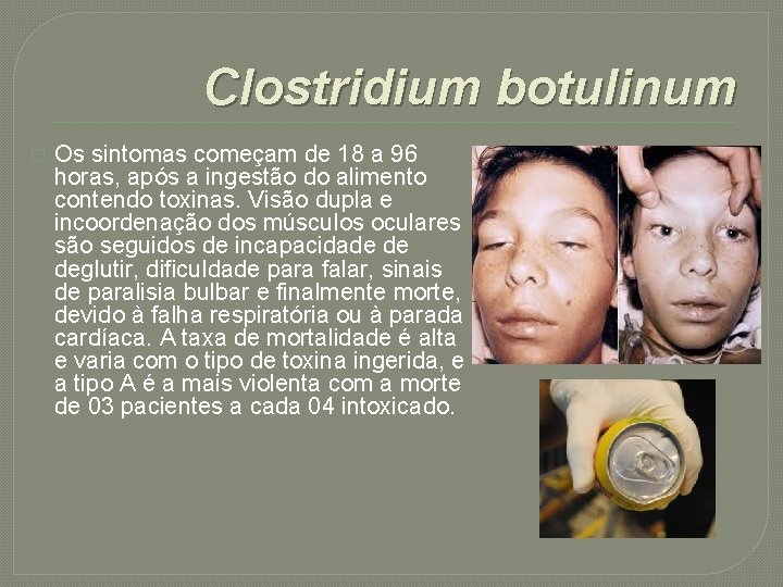 Clostridium botulinum � Os sintomas começam de 18 a 96 horas, após a ingestão
