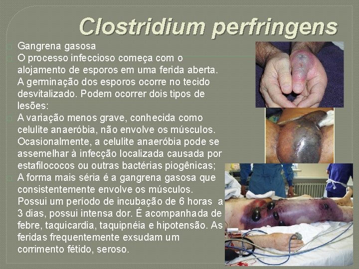 Clostridium perfringens � � Gangrena gasosa O processo infeccioso começa com o alojamento de