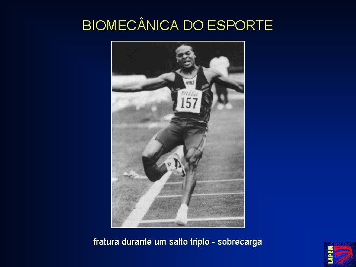 BIOMEC NICA DO ESPORTE fratura durante um salto triplo - sobrecarga 