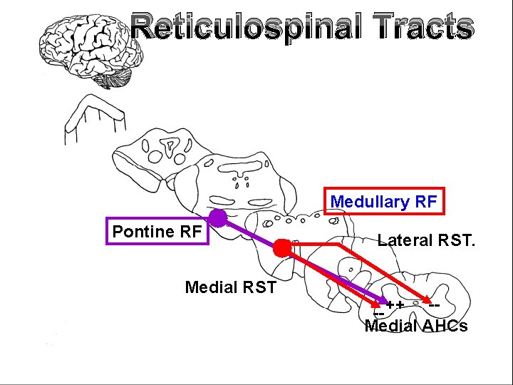 Reticulospinal Tracts Medullary RF Pontine RF Medial RST Lateral RST. -- ++ -Medial AHCs