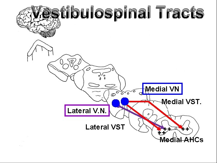 Vestibulospinal Tracts Medial VN Medial VST. Lateral V. N. Lateral VST ++++ ++ Medial