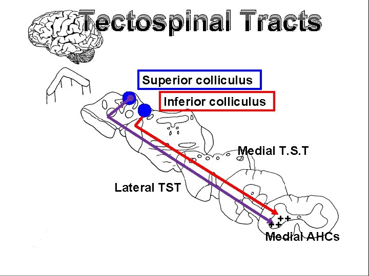 Tectospinal Tracts Superior colliculus Inferior colliculus Medial T. S. T Lateral TST ++++ Medial