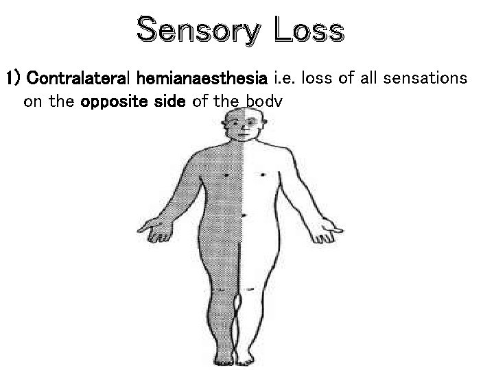 Sensory Loss 1) Contralateral hemianaesthesia i. e. loss of all sensations on the opposite