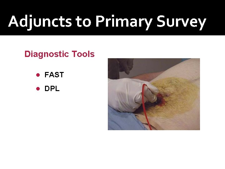 Adjuncts to Primary Survey Diagnostic Tools ● FAST ● DPL Adjuncts to Primary Survey Diagnostic Tools ● FAST ● DPL