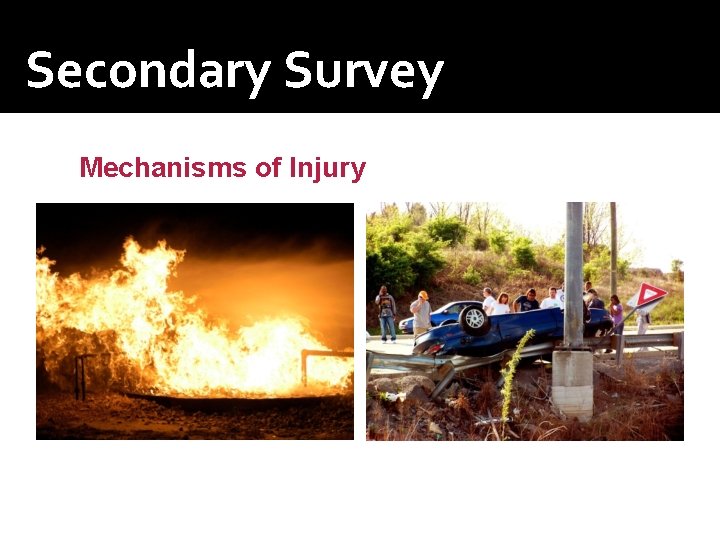 Secondary Survey Mechanisms of Injury 
