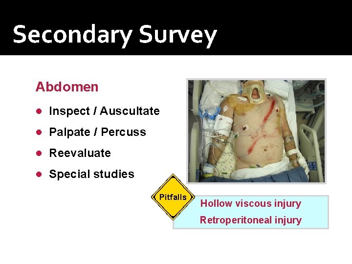 Secondary Survey Abdomen ● Inspect / Auscultate ● Palpate / Percuss ● Reevaluate ●