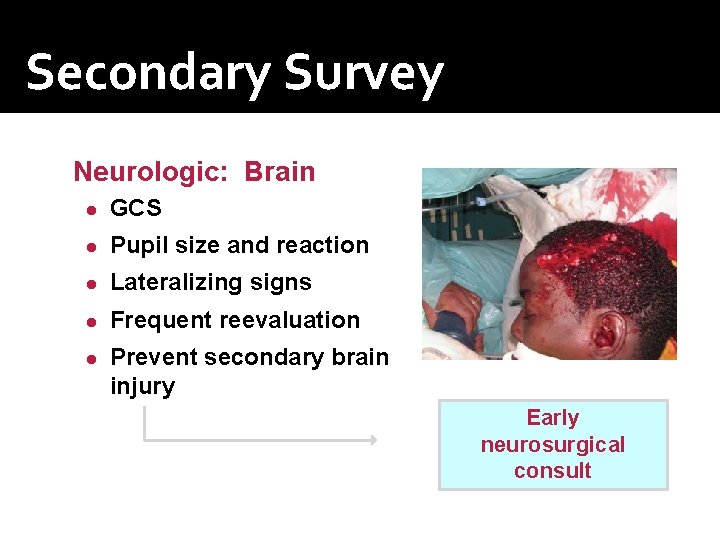 Secondary Survey Neurologic: Brain ● GCS ● Pupil size and reaction ● Lateralizing signs Secondary Survey Neurologic: Brain ● GCS ● Pupil size and reaction ● Lateralizing signs