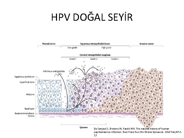 HPV DOĞAL SEYİR De Sanjosé S, Brotons M, Pavón MA. The natural history of