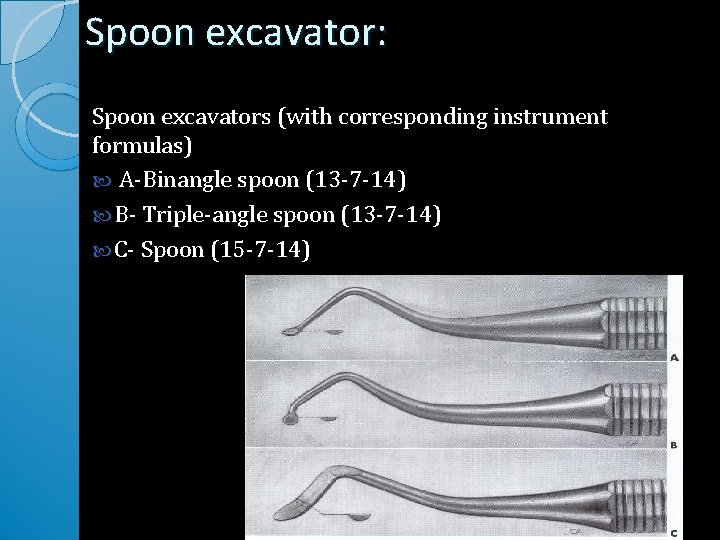 Spoon excavator: Spoon excavators (with corresponding instrument formulas) A-Binangle spoon (13 -7 -14) B-