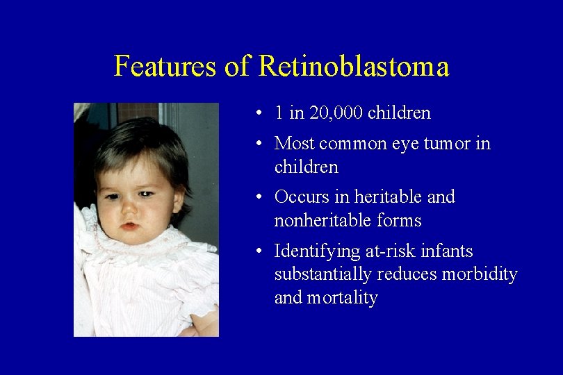 Features of Retinoblastoma • 1 in 20, 000 children • Most common eye tumor