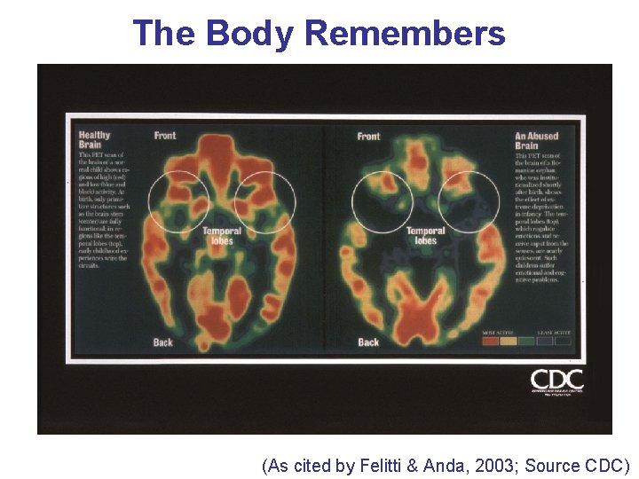 The Body Remembers (As cited by Felitti & Anda, 2003; Source CDC) 