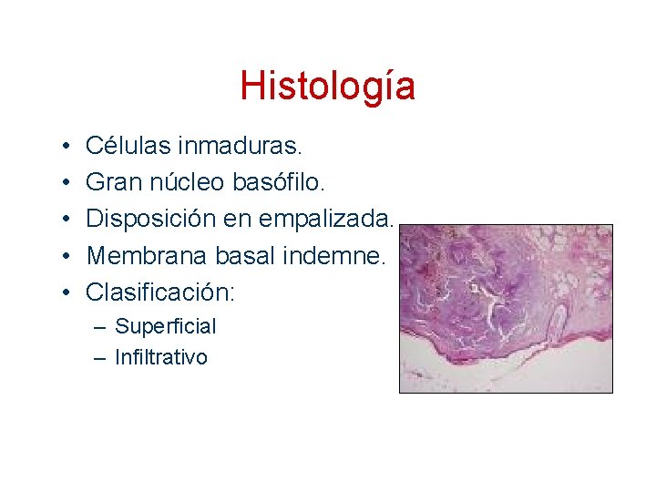 Histología • • • Células inmaduras. Gran núcleo basófilo. Disposición en empalizada. Membrana basal