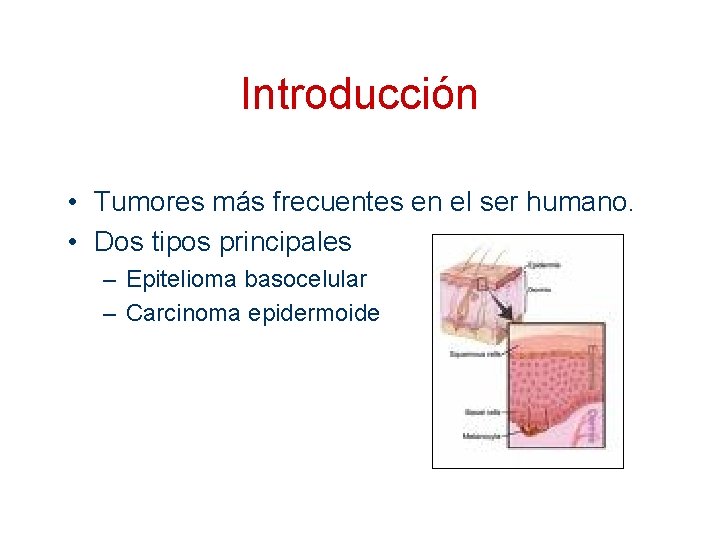 Introducción • Tumores más frecuentes en el ser humano. • Dos tipos principales –