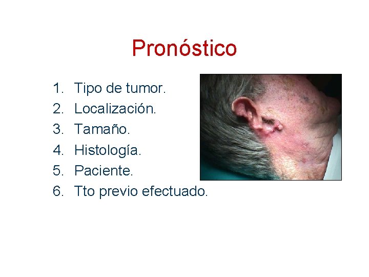 Pronóstico 1. 2. 3. 4. 5. 6. Tipo de tumor. Localización. Tamaño. Histología. Paciente.