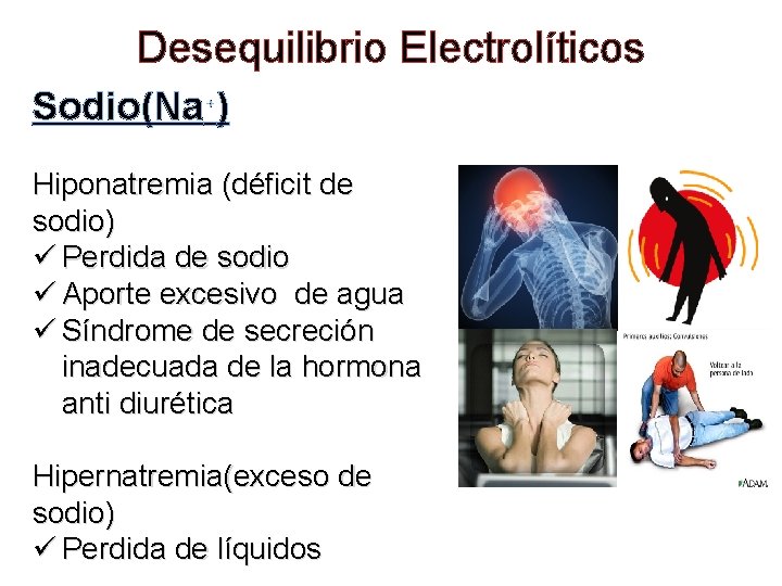 Desequilibrio Electrolíticos Sodio(Na₊) Hiponatremia (déficit de sodio) ü Perdida de sodio ü Aporte excesivo